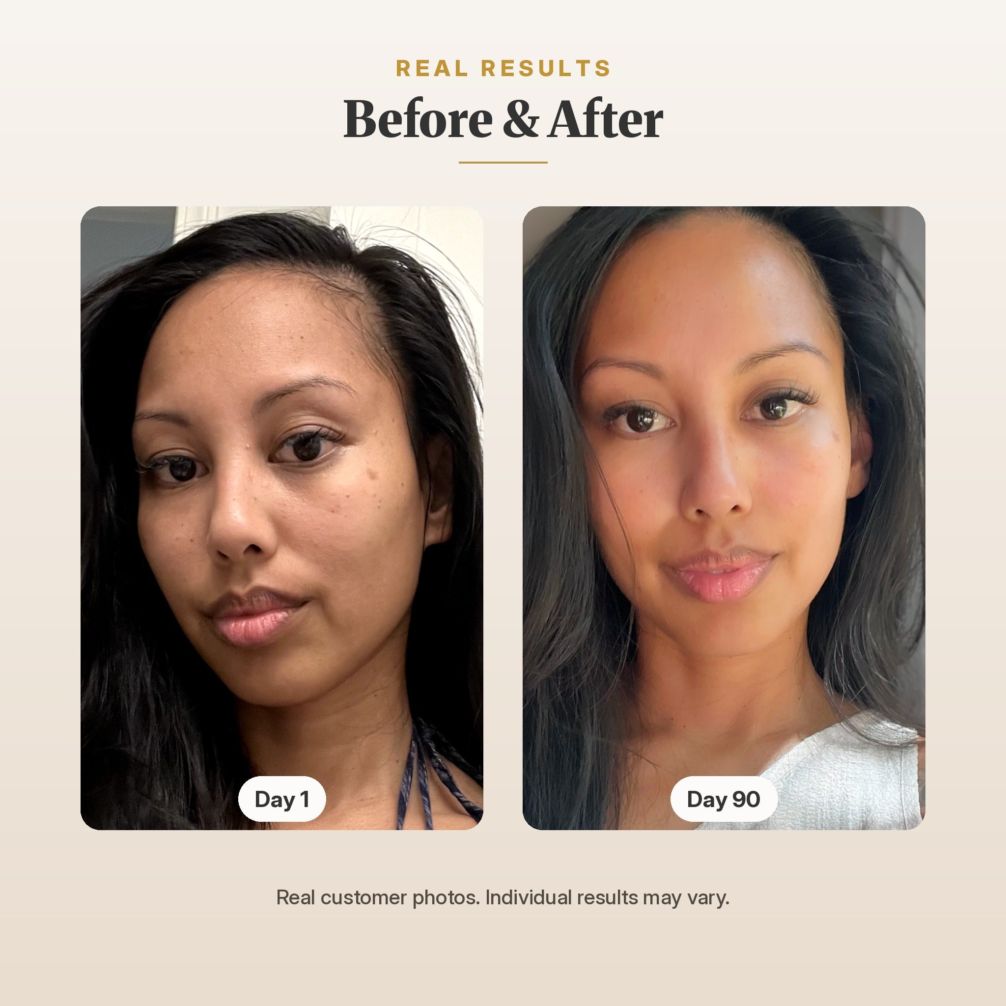 GlowUp™ LED Light Therapy Face Mask
