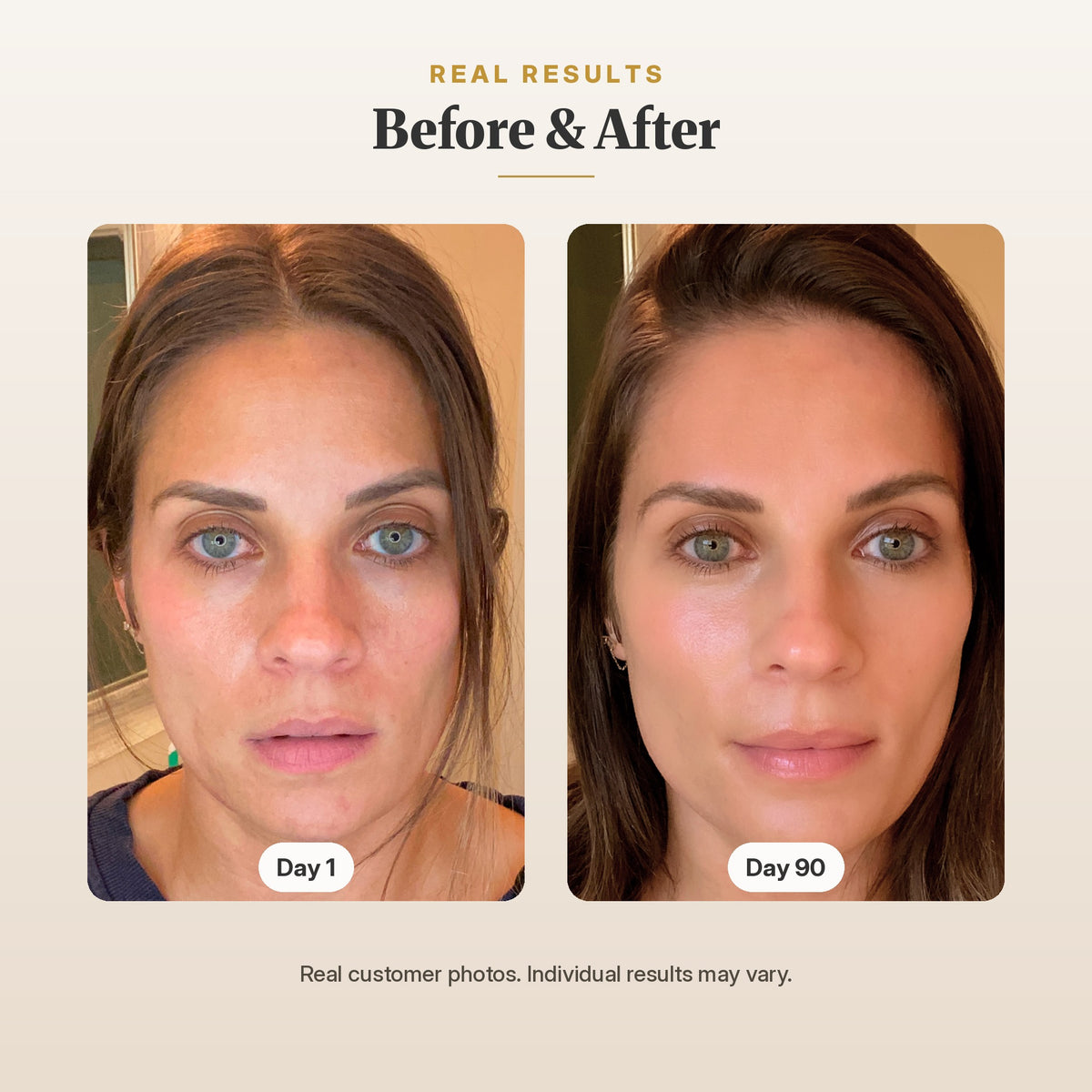 GlowUp LED Light Therapy Face Mask before and after customer comparison showing visible complexion improvements from Day 1 to Day 90.